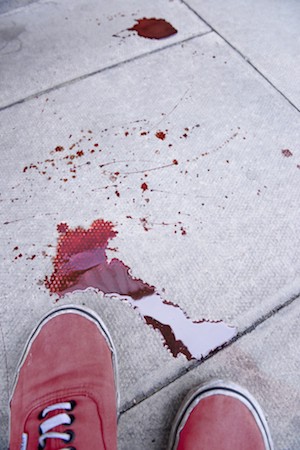 An Injury