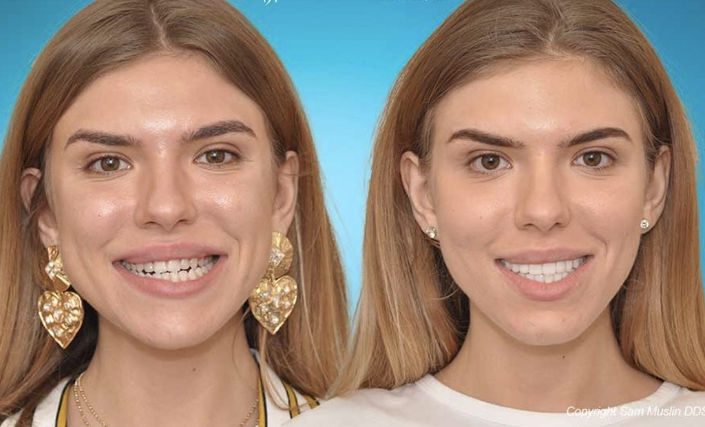 Facial aging is more than skin deep